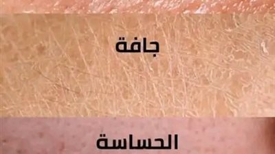 معرفة نوع بشرتك خطوة مهمة لتحديد روتين العناية المناسب لها. إليك دليل سريع لتحديد نوع بشرتك