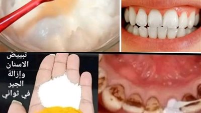 تبييض الاسنان في دقائق