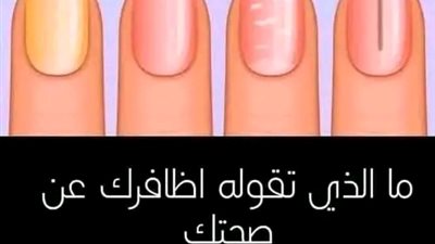 ما الذي تقوله أظافرك عن صحتك.. اعرف حالتك الصحية حسب شكل أظافرك