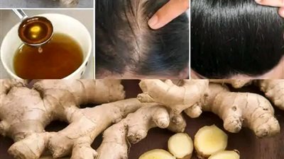 الزنجبيل لمكــافحة تساقط الشعر وتعـــزيز نمـــوه السريع