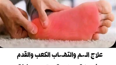 ألم الكعب عند الإستقياظ “أسباب و علاج التهاب اللفافة الأخمصي”