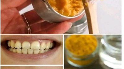 الســــر الذي لا يريدك أطبــــاء الأسنــــان أن تعرفه إزالة الجيــــر وتبييــــض الأسنان في دقيقتين