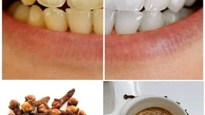 القرنفل لتبييض الاسنان 