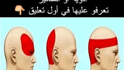 انواع الصداع 