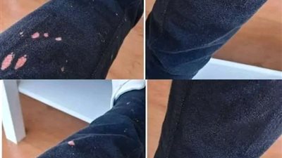 كيفية إزالة بقع الكلور مبيض الملابس من الأقمشة بخطوتين والمحافظة على الوان الملابس  