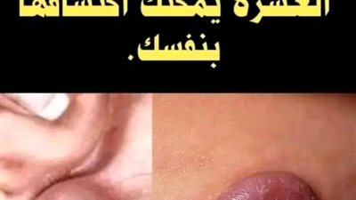اعراض السړطان 10يمكن اكتشافها بنفسك