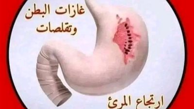 علاج انتفاخ البطن والغازات في أسبوع كوب واحد قبل النوم سيطرد غازات البطن ويعالج القولون العصبي 