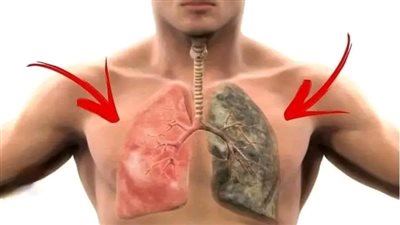 أفضل مشروب طبيعي يطهّر الرئتين من آثار الټدخين 