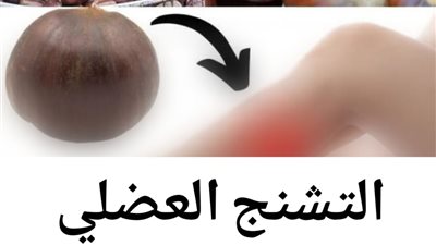 التشنج العضلي الاسباب والعلاج  التشنج العضلي من الحالات الشائعة التي قد يعاني منها الأفراد في مختلف الأعمار.