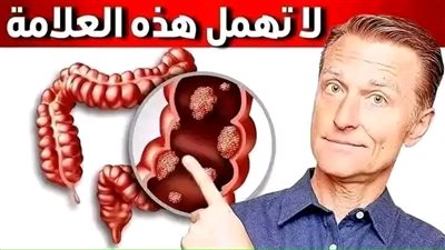 سړطان القولون لا تظهر عادة أعراضه في المراحل المبكرة هناك علامة قد تستهين بها تظهر في بداية المړض لذا عليك الحذر