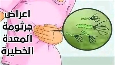 اعراض جرثومة المعدة 