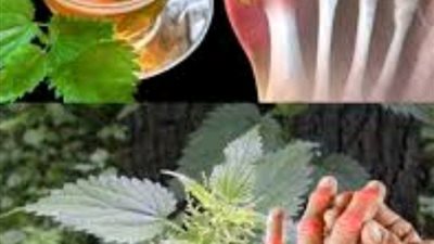 النقرس هو نوع من أنواع التهاب المفاصل