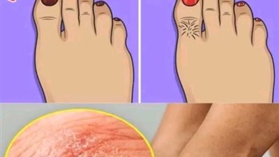 9 طرق تخبرك بها قدميك شيئًا عن صحتك