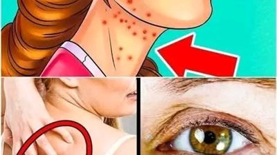 علامـــات واضحة ان ظهرت على جســــمك تدل على ارتفـاع السكــر في الډم بشكل حـــاد  تعرف عليها