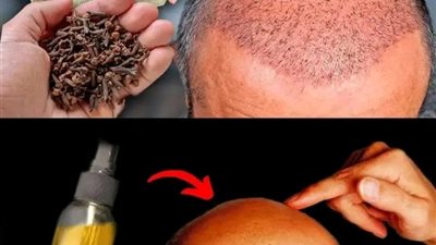 القرنفل وقشر البصل للشعر 