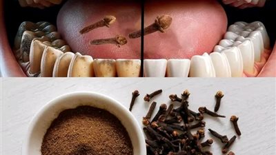 ١٦ من أفــضل الطرق الطبيعية لإزالة البـلاك والجـير المتـراكم 