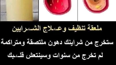 ملعقة من تلك العشبة السحريه تنظف الشــرايين وتخـرج منها الدهـون المتراكمة لسنوات