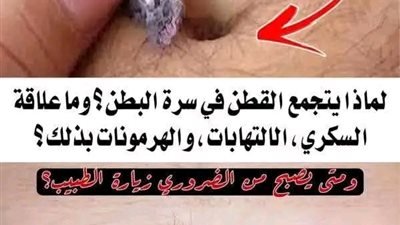 لماذا يتكون القطن في سرة البطن وماعلاقة الالتهابات ومرض السكري والاضرابات الهرمونية في ذلك و متى يجب الذهاب للطبيب؟