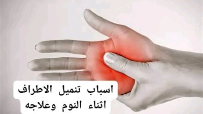 اسباب تنميل الاطراف اثناء النوم وعلاجه 