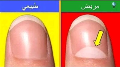 هل تساءلت يوما ماهذا القوس الابيض الموجود على الاظافر
