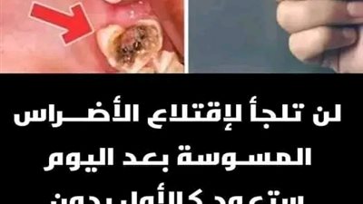 لن تلجأ لإقتلاع الأضــراس المسوسة بعد اليوم ستعود بدون تسـوس ولا ثقب عـلاج التسـوس 