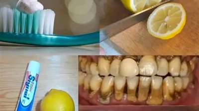 خلــــطة طبيــــعية لتبييــــض الأسنان الصــــفراء في المنــــزل طــــريقة مجــــربة