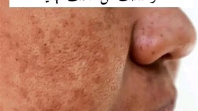 والله ثم والله اقوى وصفه تبيض الوجه وانتى نايمه لو عندك سواد السنين مضمونه