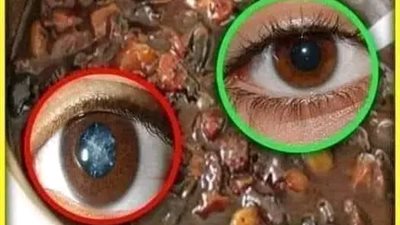 علاج ضعف النظر وتقويه شبكة العين وصفة للتقوية في 3 دقائق فقط 