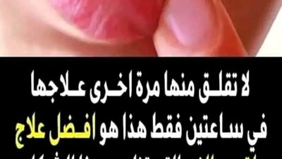 لا تقلق منها مرة اخري علاجـها في ساعتين فقط هذا هو افضل علاج لقـرح الفم التي تظهر بهذا الشكل 