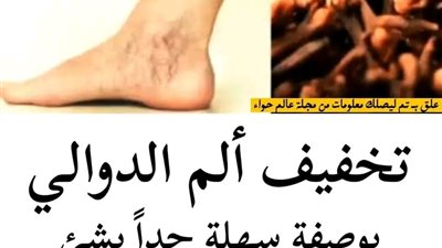 كيف تعـالج دوالي السـاقين الأسبـاب والعـلاج  