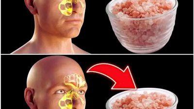 وصفة ربانية للتخلـص من الزكام وتفعيل أنفك وطـرد البلغم 