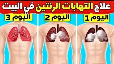 أقوى علاج طبيعي يقضي على التهاب الرئة والصدر والشعب الهوائية والسعال